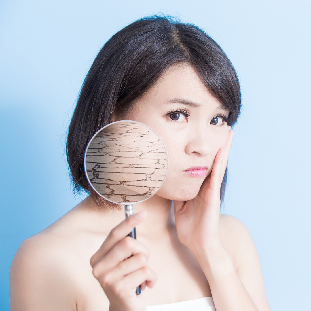 Is Your Dry Skin Causing Wrinkles? | 3 Preventative Tips