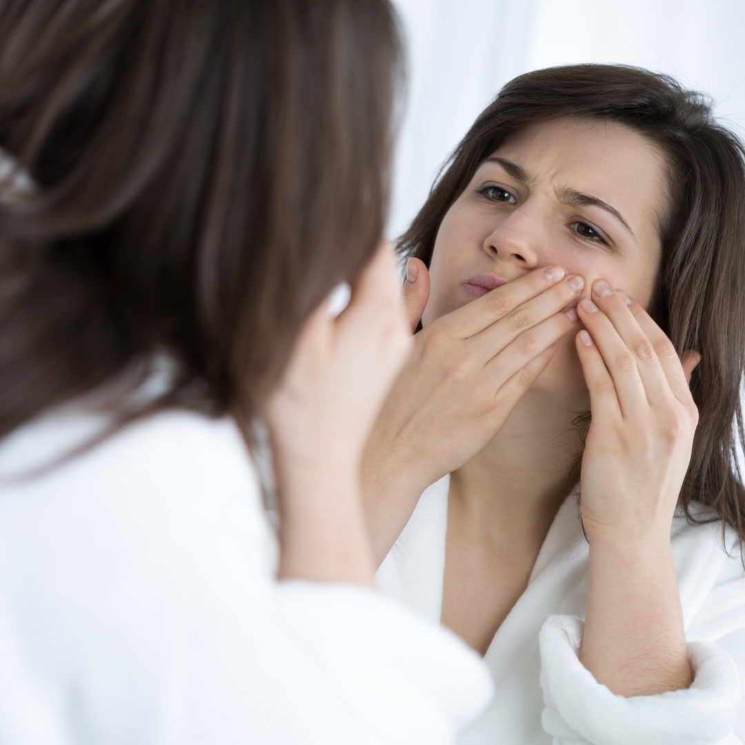 How Are Your Always Changing Hormones Affecting Your Skin?